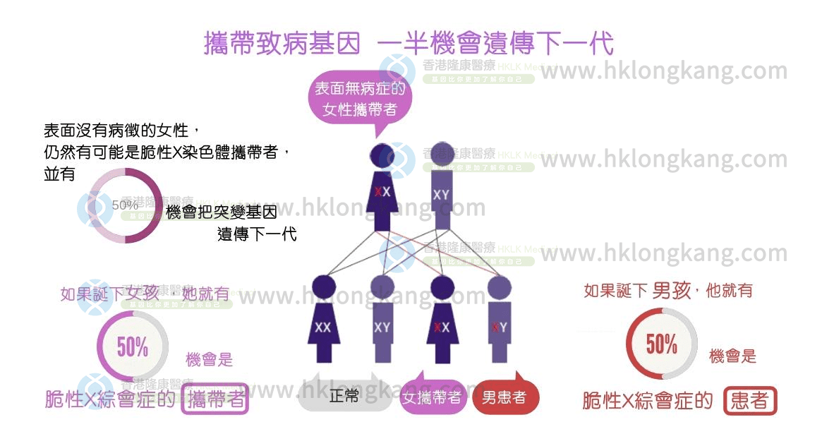 脆性X綜合症